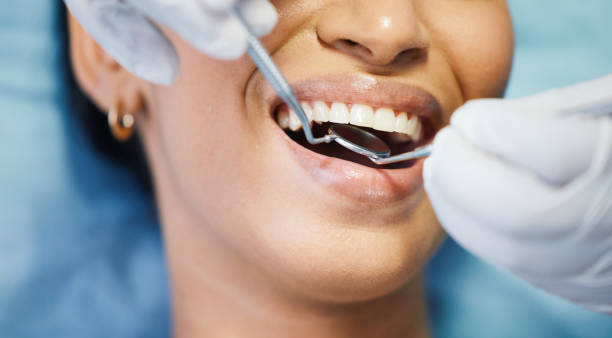 Best Emergency Dental Extractions in Pocahontas, IA